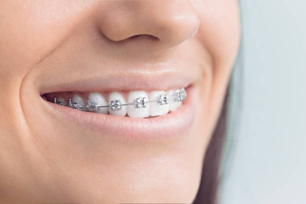 Best Veneers and Lumineers  in Croswell, MI